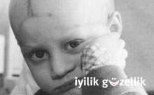 �ocuklar kanser olmas�n!