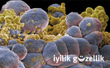 Alkol ve kanserin samimi ilişkisi!