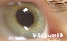 Göz tedavisinde yanlış damla kullanımı