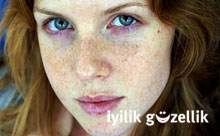Açık tenliler dikkat!